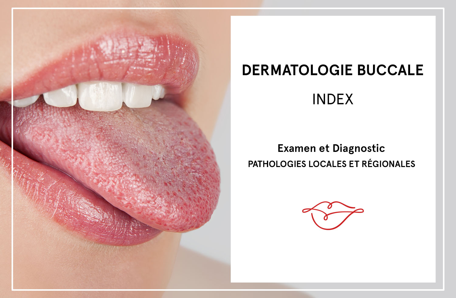 dermatologie buccale