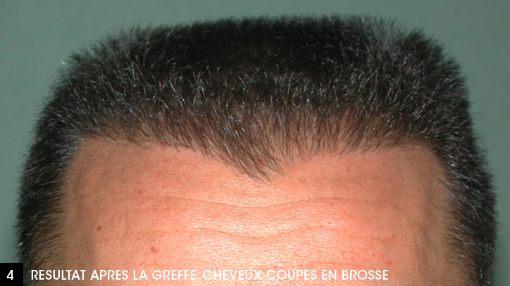 cheveux coupes en brosse