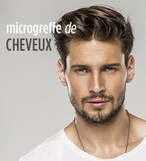 micro greffes de cheveux