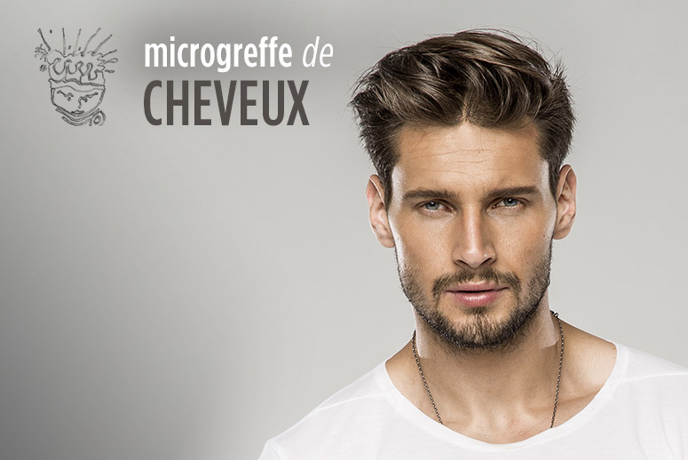 greffe de cheveux