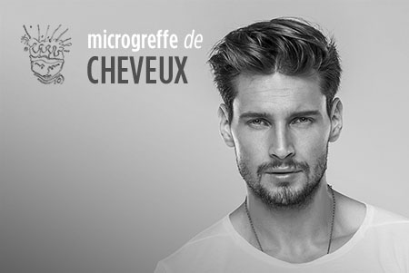 microgreffes de cheveux