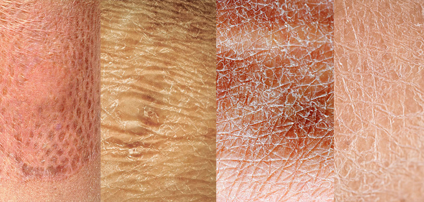 peau dermatologie
