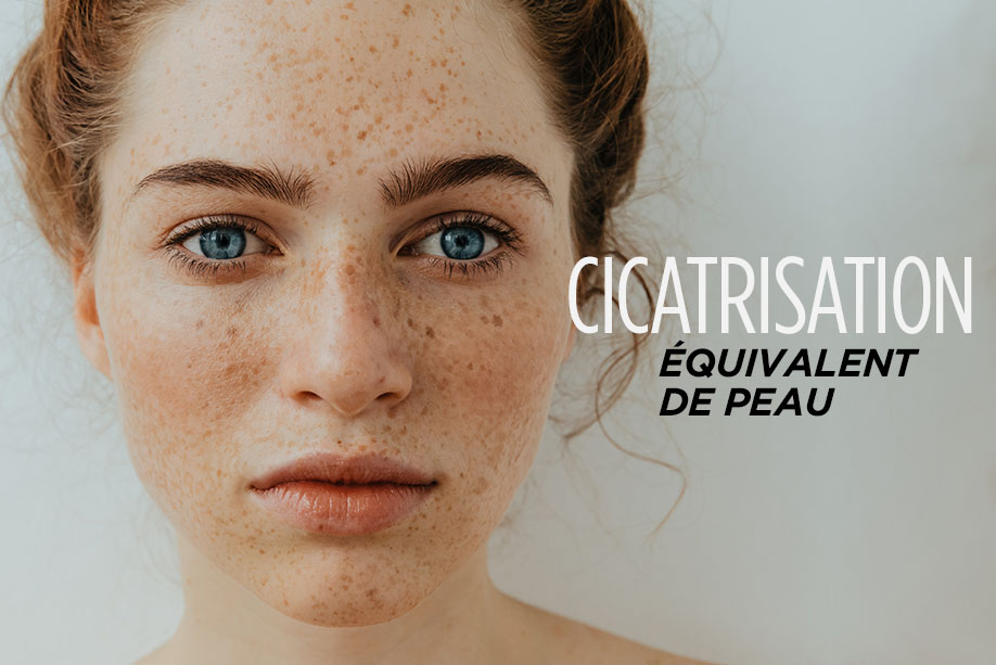 dermatologie chirurgicale acné