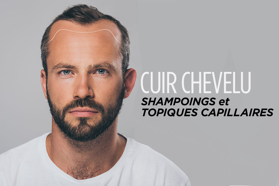 cuir chevelu shampoins et topiques capillaires